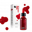 Пилинг-сыворотка с кислотами SKIN1004 Zombie Beauty Bloody Peel, 30 мл